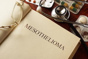 Book Diagnosis Mesothelioma Medic Concept